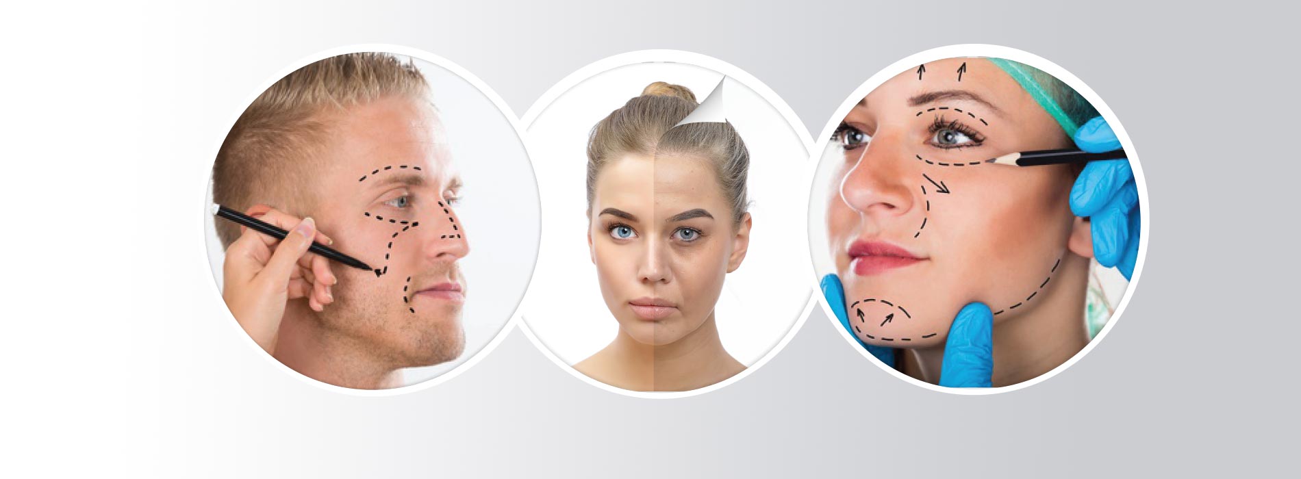 Cirugía Plastica Estetica Facial en Oviedo y Gijon Doctores Rehberger
