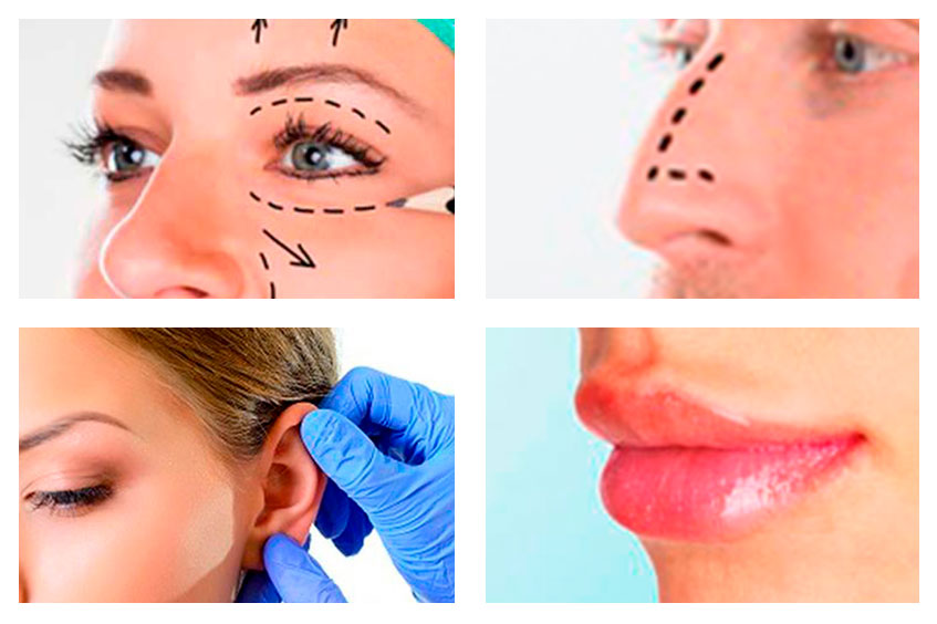 Top 4 Tratamientos de Cirugía Estética Facial - Dr. Federico Rehberger