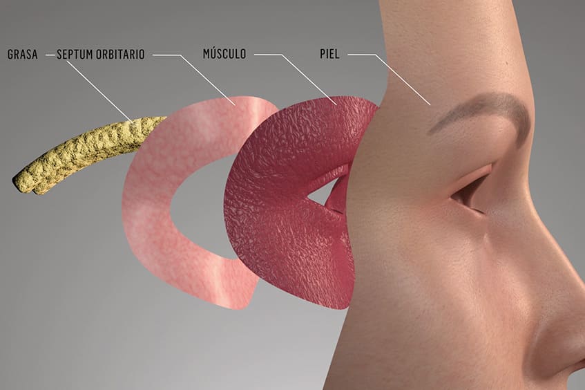 anatomia-parpado-blefaroplastia-cirugia-de-párapados-operación-de-párpados-en-asturias-oviedo-gijon