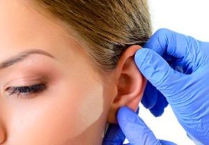 otoplastias-en-oviedo
